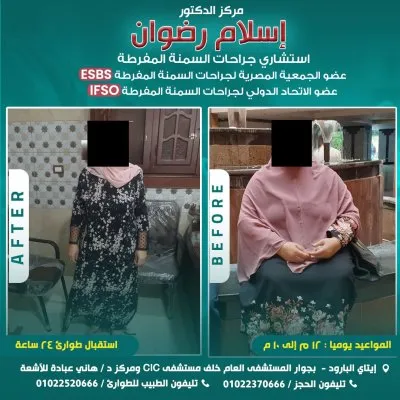 دكتور اسلام رضوان استشاري جراحة عامة ومناظير وسمنة مفرطة