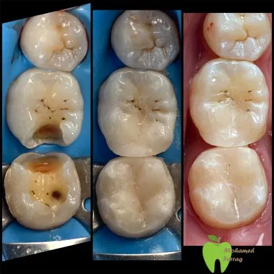 دكتور محمد فراج استشاري طب أسنان الأطفال والتقويم