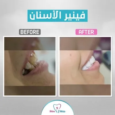 دكتور محمد يحيى مركز شاين اند وايت لطب الأسنان