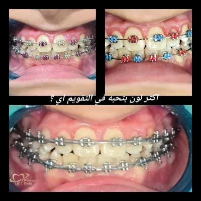 مركز العاصمة دكتور محمد رضا مصطفي لطب الفم وتقويم وتجميل الاسنان