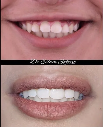 دكتور اسلام صفوت اخصائي طب الاسنان