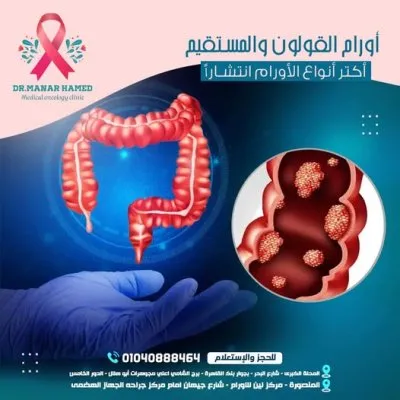 دكتورة منار حامد شعبان مدرس و استشاري طب الأورام