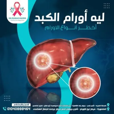 دكتورة منار حامد شعبان مدرس و استشاري طب الأورام