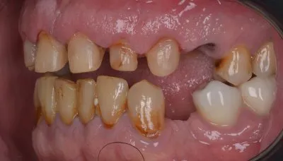 دكتور عمر الجزار أخصائى تقويم شفاف وتجميل أسنان