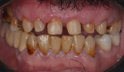 دكتور عمر الجزار أخصائى تقويم شفاف وتجميل أسنان