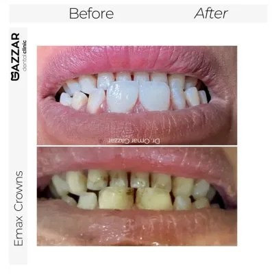 دكتور عمر الجزار أخصائى تقويم شفاف وتجميل أسنان