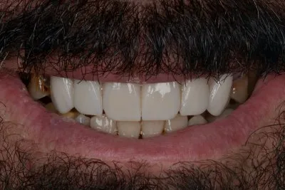 دكتور عمر الجزار أخصائى تقويم شفاف وتجميل أسنان