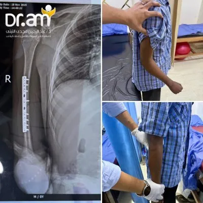 دكتور عبد الرحمن مجدى التيتى أخصائى علاج طبيعى