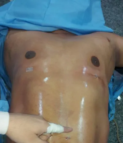 دكتور احمد فوزي السيد استشارى و دكتوراه جراحة التجميل والحروق