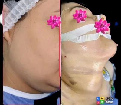 دكتور احمد فوزي السيد استشارى و دكتوراه جراحة التجميل والحروق