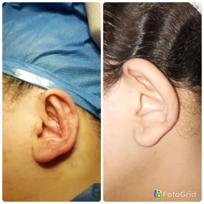 دكتور احمد فوزي السيد استشارى و دكتوراه جراحة التجميل والحروق
