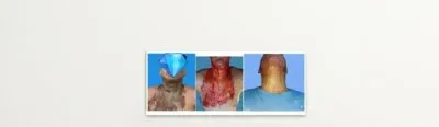 دكتور احمد فوزي السيد استشارى و دكتوراه جراحة التجميل والحروق