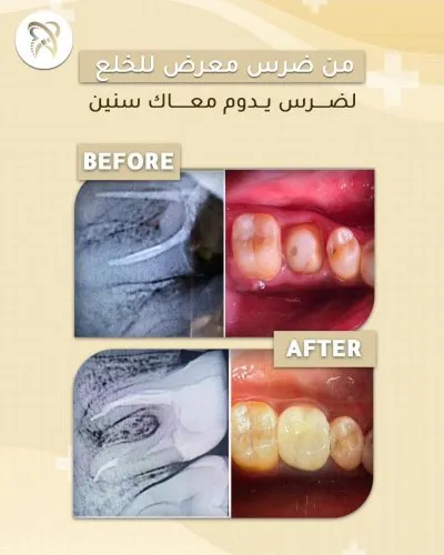 Dental clinic x  دكتور محمود عصام العزب