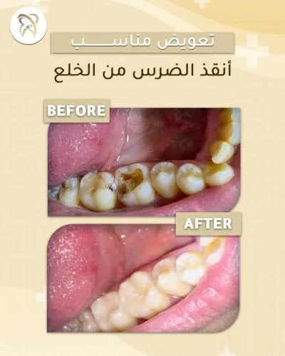 Dental clinic x  دكتور محمود عصام العزب