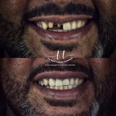 دكتور عمرو طارق فاروق أخصائي طب وزراعة وتجميل الأسنان