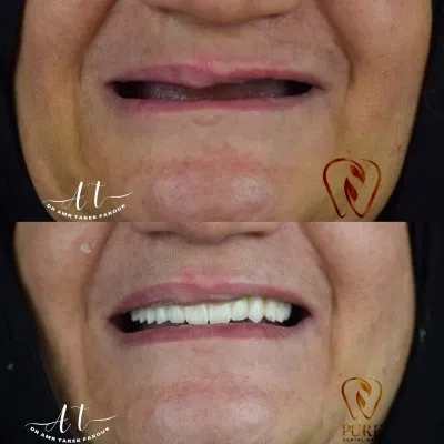 دكتور عمرو طارق فاروق أخصائي طب وزراعة وتجميل الأسنان