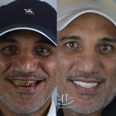 دكتور عمرو طارق فاروق أخصائي طب وزراعة وتجميل الأسنان