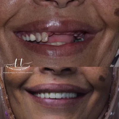 دكتور عمرو طارق فاروق أخصائي طب وزراعة وتجميل الأسنان