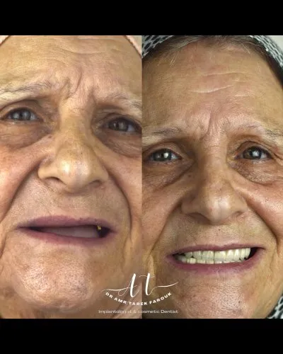 دكتور عمرو طارق فاروق أخصائي طب وزراعة وتجميل الأسنان