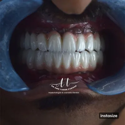 دكتور عمرو طارق فاروق أخصائي طب وزراعة وتجميل الأسنان