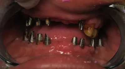 مركز الأستاذ الدكتور محمد محمود الكاتب لطب الاسنان