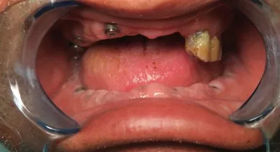 مركز الأستاذ الدكتور محمد محمود الكاتب لطب الاسنان