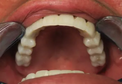 مركز الأستاذ الدكتور محمد محمود الكاتب لطب الاسنان