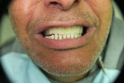 مركز الأستاذ الدكتور محمد محمود الكاتب لطب الاسنان