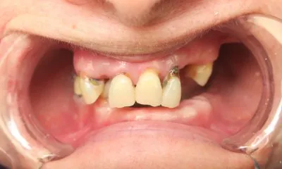 مركز الأستاذ الدكتور محمد محمود الكاتب لطب الاسنان