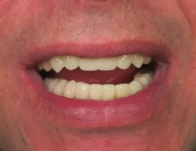 مركز الأستاذ الدكتور محمد محمود الكاتب لطب الاسنان