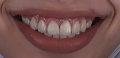  عيادة بيكاسو دكتور محمد عمر أخصائي تجميل الأسنان