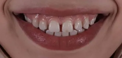  عيادة بيكاسو دكتور محمد عمر أخصائي تجميل الأسنان
