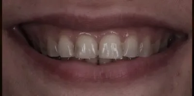  عيادة بيكاسو دكتور محمد عمر أخصائي تجميل الأسنان