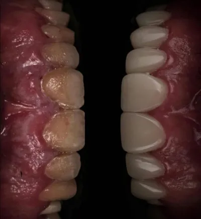 Dental Valley Clinic دكتورة دعاء محمد حسن علي
