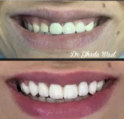 Dental Valley Clinic دكتورة دعاء محمد حسن علي