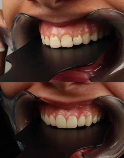 Dental Valley Clinic دكتورة دعاء محمد حسن علي