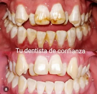 دكتورة داليا عبد الموجود استشاري تجميل الاسنان 
