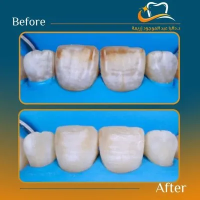 دكتورة داليا عبد الموجود استشاري تجميل الاسنان 