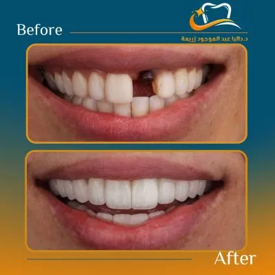 دكتورة داليا عبد الموجود استشاري تجميل الاسنان 