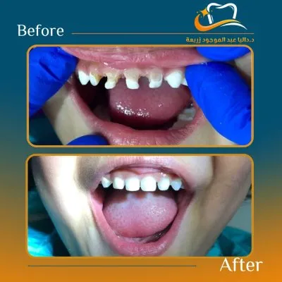 دكتورة داليا عبد الموجود استشاري تجميل الاسنان 