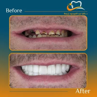 دكتورة داليا عبد الموجود استشاري تجميل الاسنان 