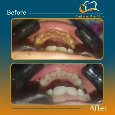 دكتورة داليا عبد الموجود استشاري تجميل الاسنان 