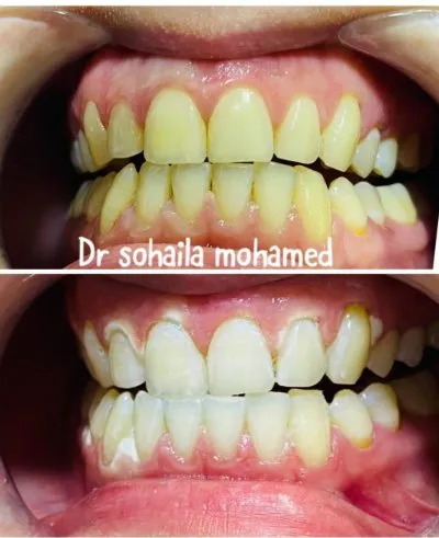 Dental Valley Clinic دكتورة دعاء محمد حسن علي