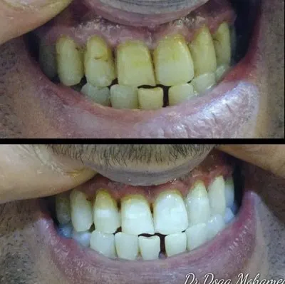 Dental Valley Clinic دكتورة دعاء محمد حسن علي