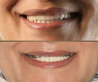 Dental Valley Clinic دكتورة دعاء محمد حسن علي