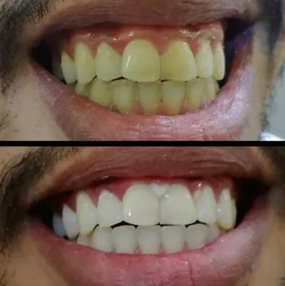 Dental Valley Clinic دكتورة دعاء محمد حسن علي