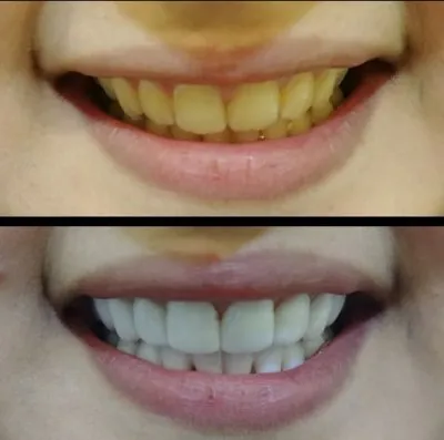 Dental Valley Clinic دكتورة دعاء محمد حسن علي