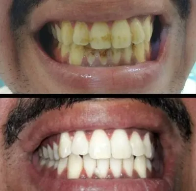 Dental Valley Clinic دكتورة دعاء محمد حسن علي