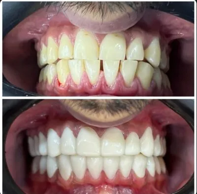 Dental Valley Clinic دكتورة دعاء محمد حسن علي