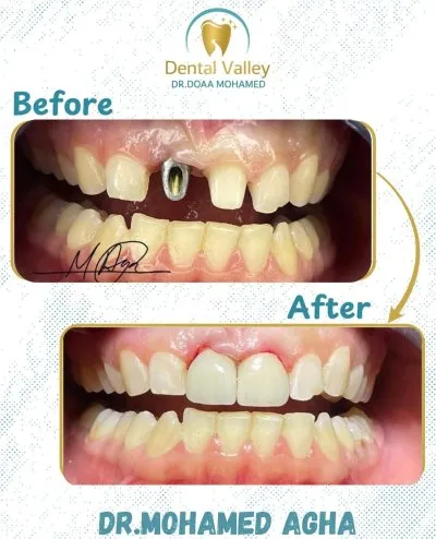 Dental Valley Clinic دكتورة دعاء محمد حسن علي